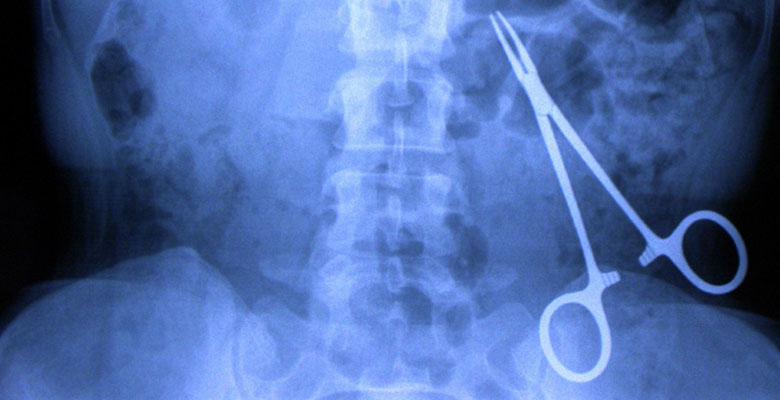 Oubli d’instrument chirurgical : un patient subit des séquelles graves