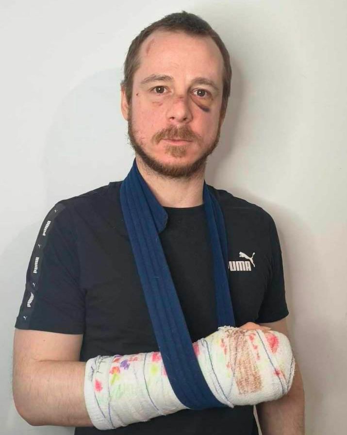 Violence Homophobe à Murcie : Un Conseiller Socialiste Agressé Dans un Kebab