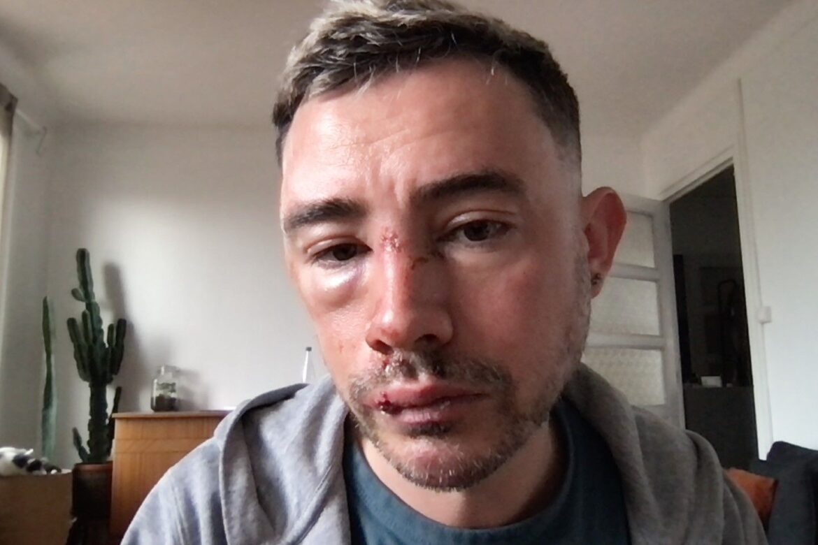 Un homme agresse deux hommes à Aubagne avec un couteau suisse : des propos homophobes et des violences brutales