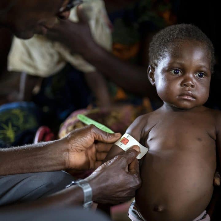 L’obésité infantile détruit la santé des enfants : l’UNICEF sonne l’alarme